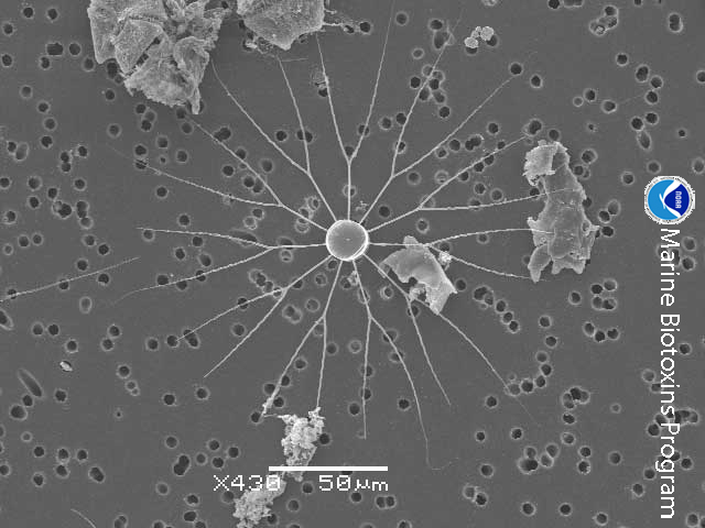 microplastic